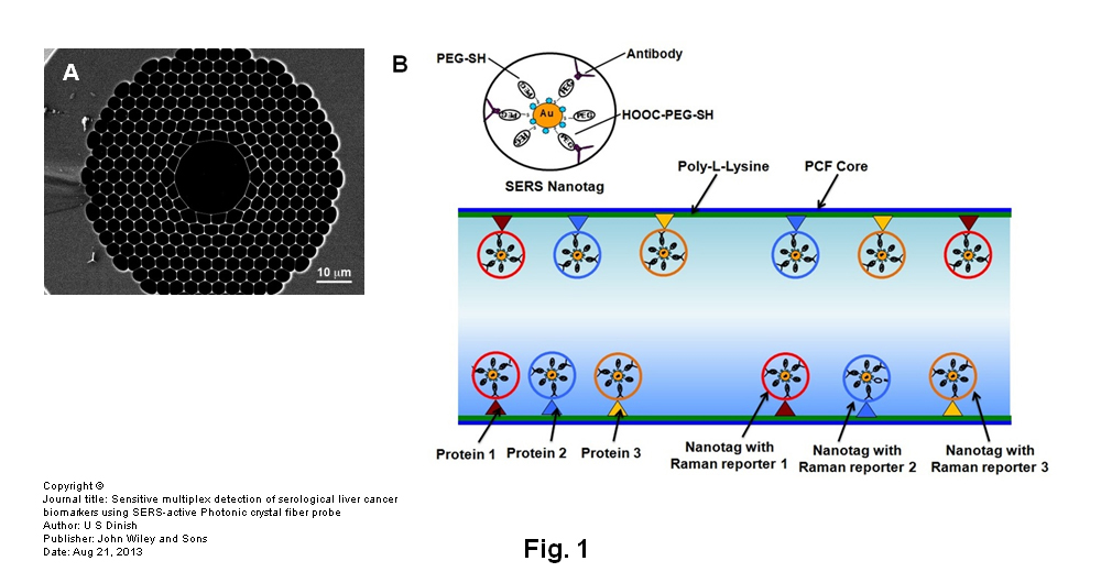 Case study: Case study: © Singapore Bioimaging Consortium (SBIC)