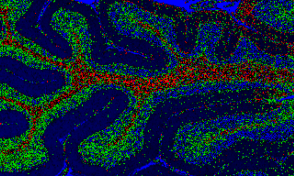 Raman-bild på hjärnvävnad
