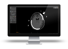 co-registrazione automatica di dati neuroinspire